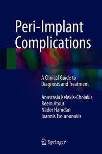 Peri-Implant Complications