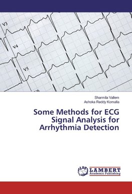 Some Methods for ECG Signal Analysis for Arrhythmia Detection