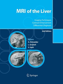 MRI of the Liver
