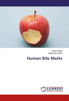 Human Bite Marks