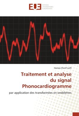 Traitement et analyse du signal Phonocardiogramme