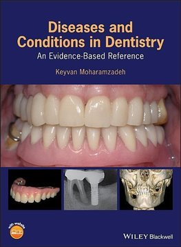 Moharamzadeh, K: Diseases and Conditions in Dentistry