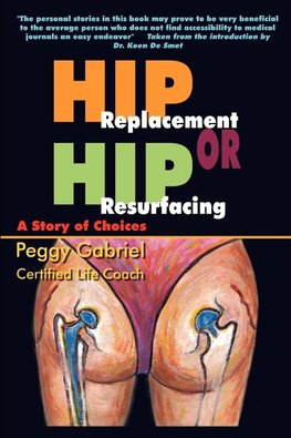 Hip Replacement or Hip Resurfacing