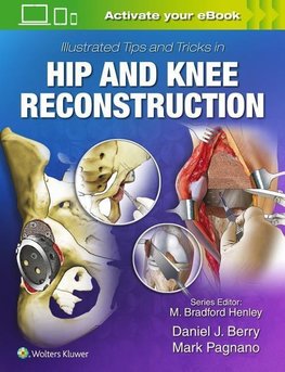 Illustrated Tips and Tricks in Hip and Knee Reconstructive and Replacement Surgery