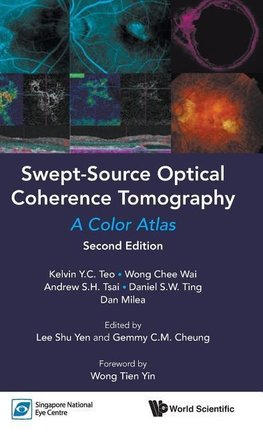 SWEPT-SOURCE OPTIC COHE (2ND ED)