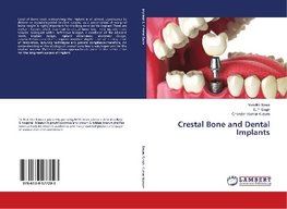 Crestal Bone and Dental Implants
