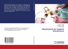 Attachments for Implant Overdenture