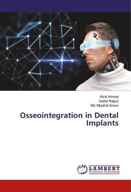 Osseointegration in Dental Implants