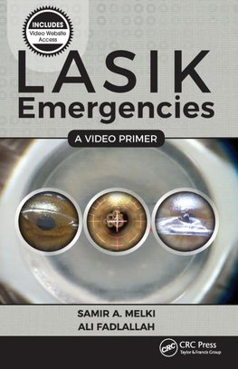 LASIK Emergencies