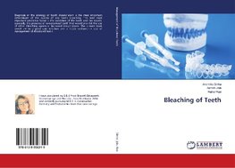 Bleaching of Teeth