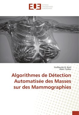 Algorithmes de Détection Automatisée des Masses sur des Mammographies