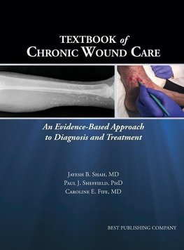 Textbook of Chronic Wound Care