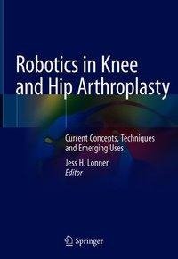 Robotics in Knee and Hip Arthroplasty