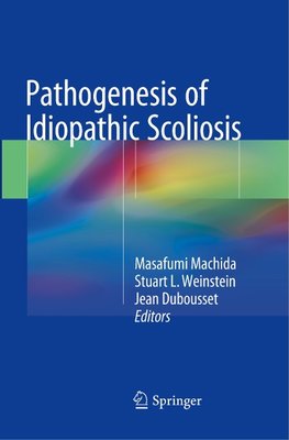 Pathogenesis of Idiopathic Scoliosis