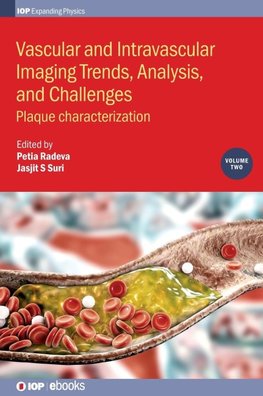 Vascular and Intravaslcular Imaging Trends, Analysis, and Challenges  - Volume 2