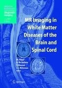 MR Imaging in White Matter Diseases of the Brain and Spinal Cord