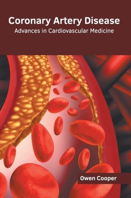 Coronary Artery Disease