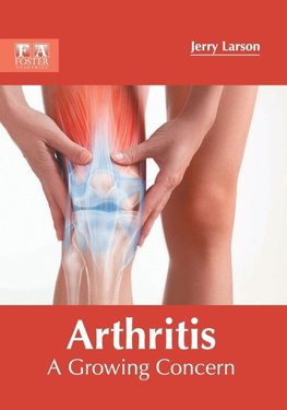 Arthritis
