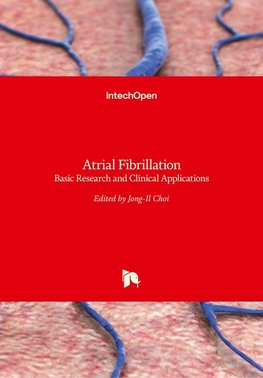 Atrial Fibrillation