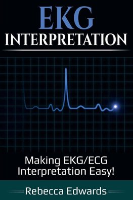 EKG Interpretation
