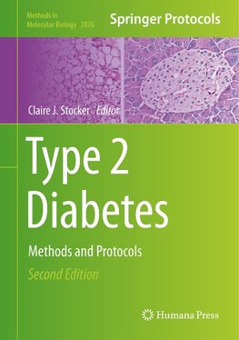 Type 2 Diabetes