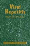 Viral Hepatitis