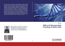 MRI and Nanoparticle Tracking of Stem Cells