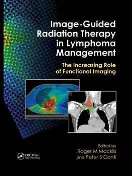 Image-Guided Radiation Therapy in Lymphoma Management