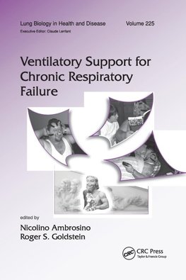 Ventilatory Support for Chronic Respiratory Failure