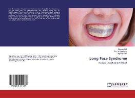 Long Face Syndrome