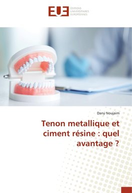 Tenon metallique et ciment résine : quel avantage ?