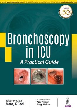 Bronchoscopy in ICU