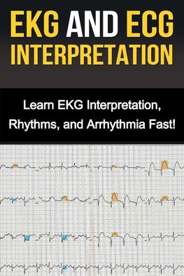 EKG and ECG Interpretation
