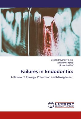 Failures in Endodontics