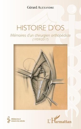 Histoire d'os