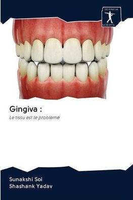 Gingiva :