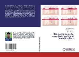 Beginners Guide for Immediate loading of Dental Implants
