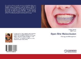 Open Bite Malocclusion