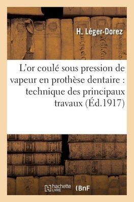 L'or coulé sous pression de vapeur en prothèse dentaire