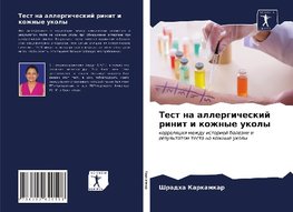 Test na allergicheskij rinit i kozhnye ukoly