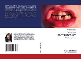 ROOT FRACTURES