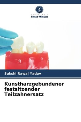 Kunstharzgebundener festsitzender Teilzahnersatz