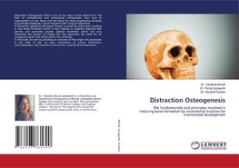 Distraction Osteogenesis