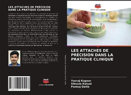 LES ATTACHES DE PRÉCISION DANS LA PRATIQUE CLINIQUE