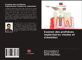 Examen des prothèses implantaires vissées et cimentées