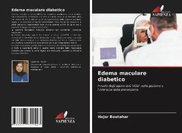 Edema maculare diabetico