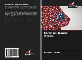 Carcinomi lobulari invasivi