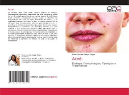 Acné: