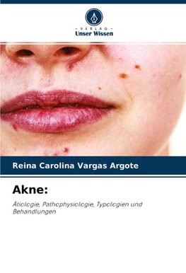 Akne: