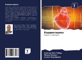 Kardiotireoz